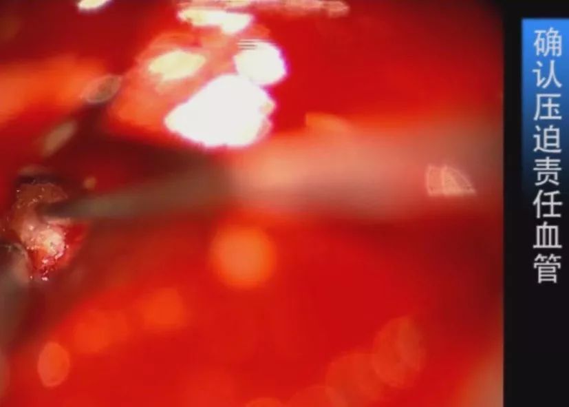 97色综合 无限臀山