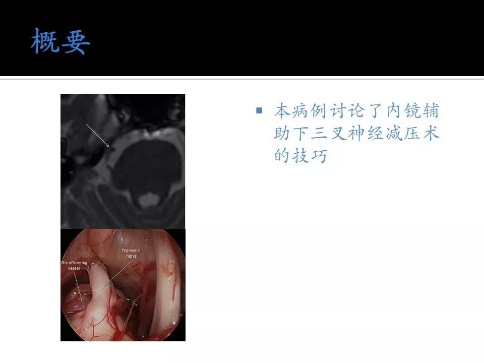 小马开大车小说