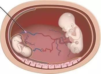 困困兔最新视频 兔最角色设计圆润可爱