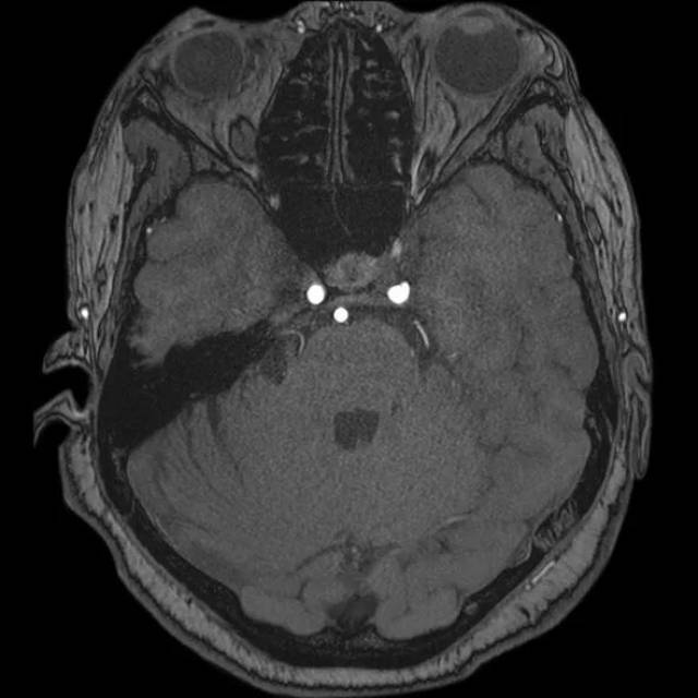 crazy老张 做事不按常理出牌的张姓人物